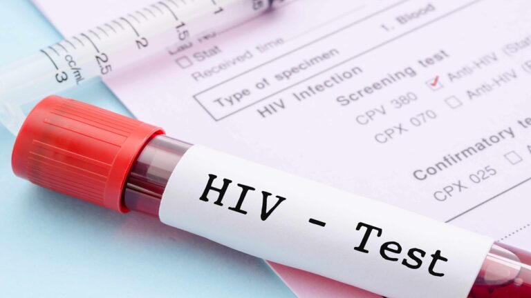 Hiv Testi Nedir?