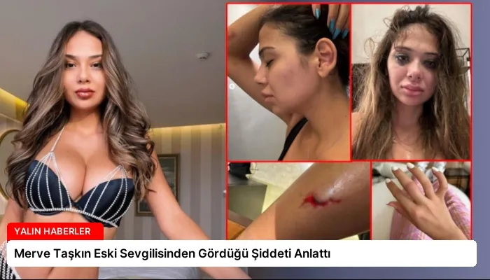 Merve Taşkın Eski Sevgilisinden Gördüğü Şiddeti Anlattı