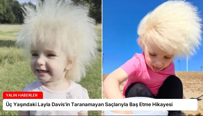 Üç Yaşındaki Layla Davis’in Taranamayan Saçlarıyla Baş Etme Hikayesi