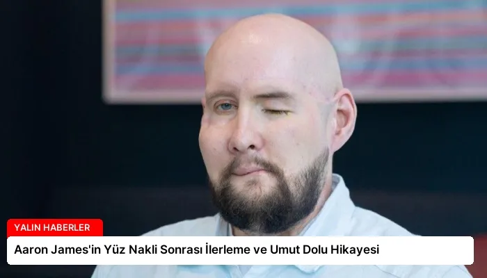 Aaron James’in Yüz Nakli Sonrası İlerleme ve Umut Dolu Hikayesi