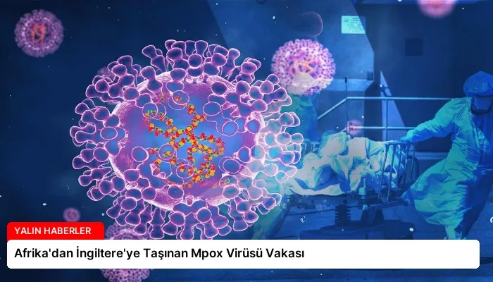 Afrika’dan İngiltere’ye Taşınan Mpox Virüsü Vakası