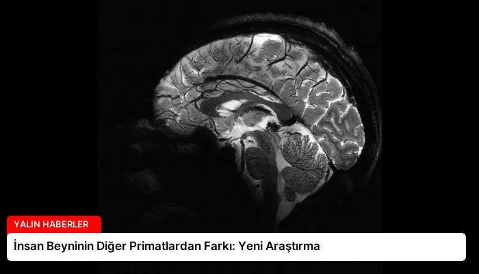 İnsan Beyninin Diğer Primatlardan Farkı: Yeni Araştırma
